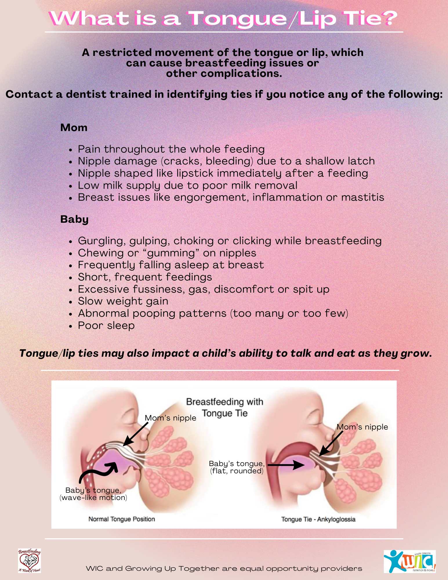 What is a tongue tie.jpg
