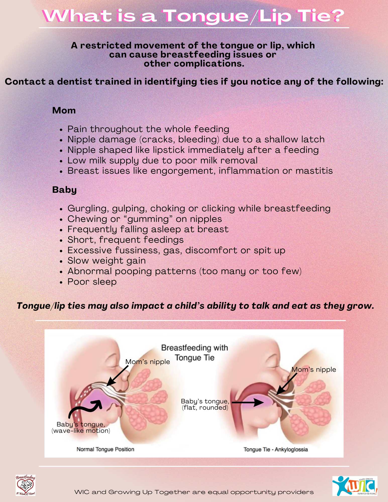 What is a tongue tie.jpg